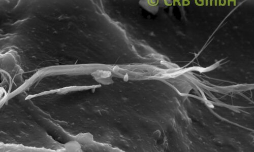Imagen MEB de amianto crisotilo en cola negra | © CRB Analysis Service GmbH